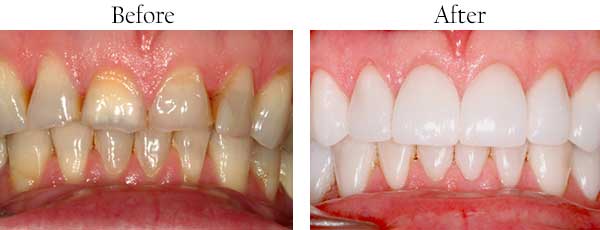 dental images 10549